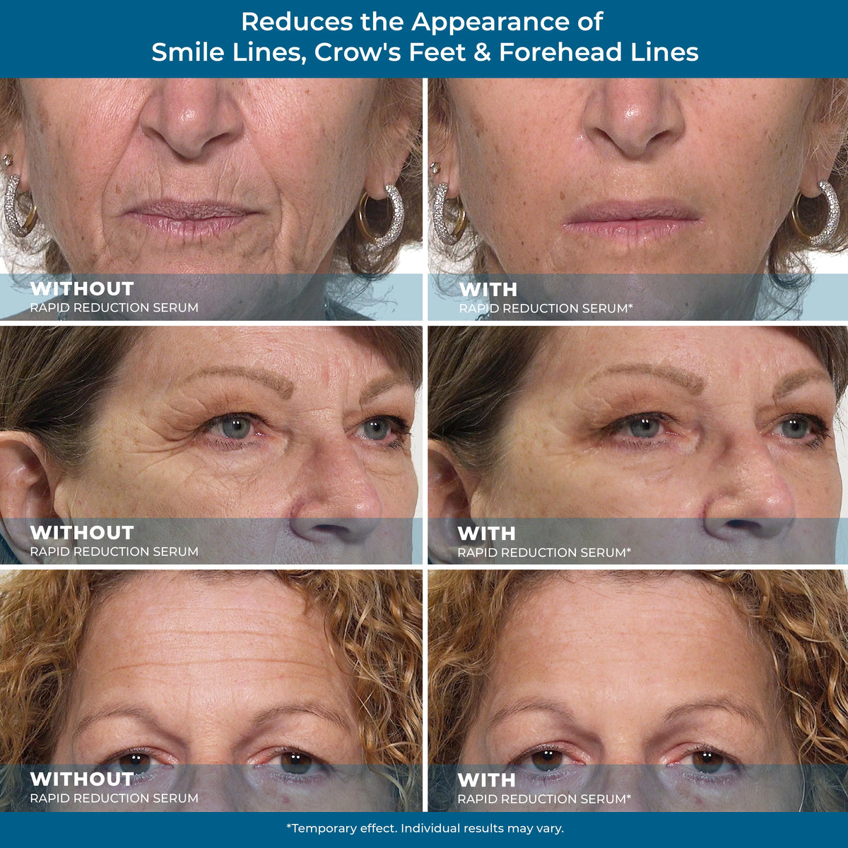 Rapid Reduction Eye Serum H1884